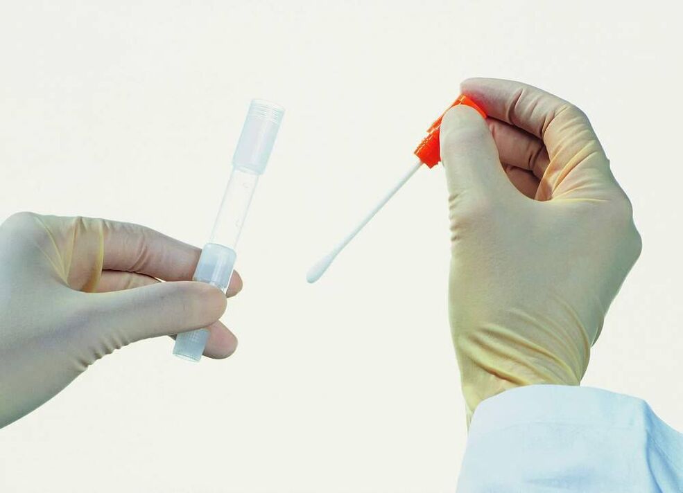 Sběr analýzy pro detekci chronické prostatitidy