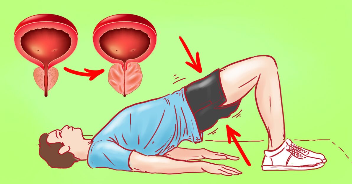 Terapeutická cvičení pro chronickou prostatitidu