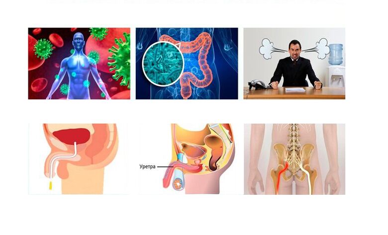 příčiny prostatitidy