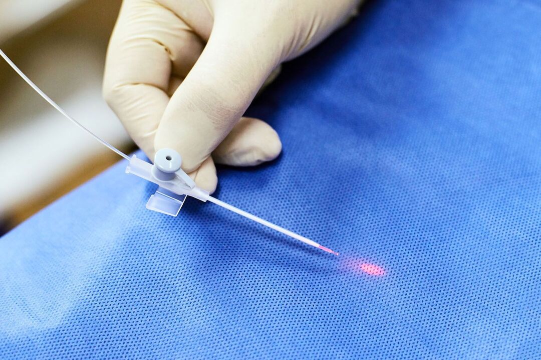transrektální zařízení pro léčbu prostaty