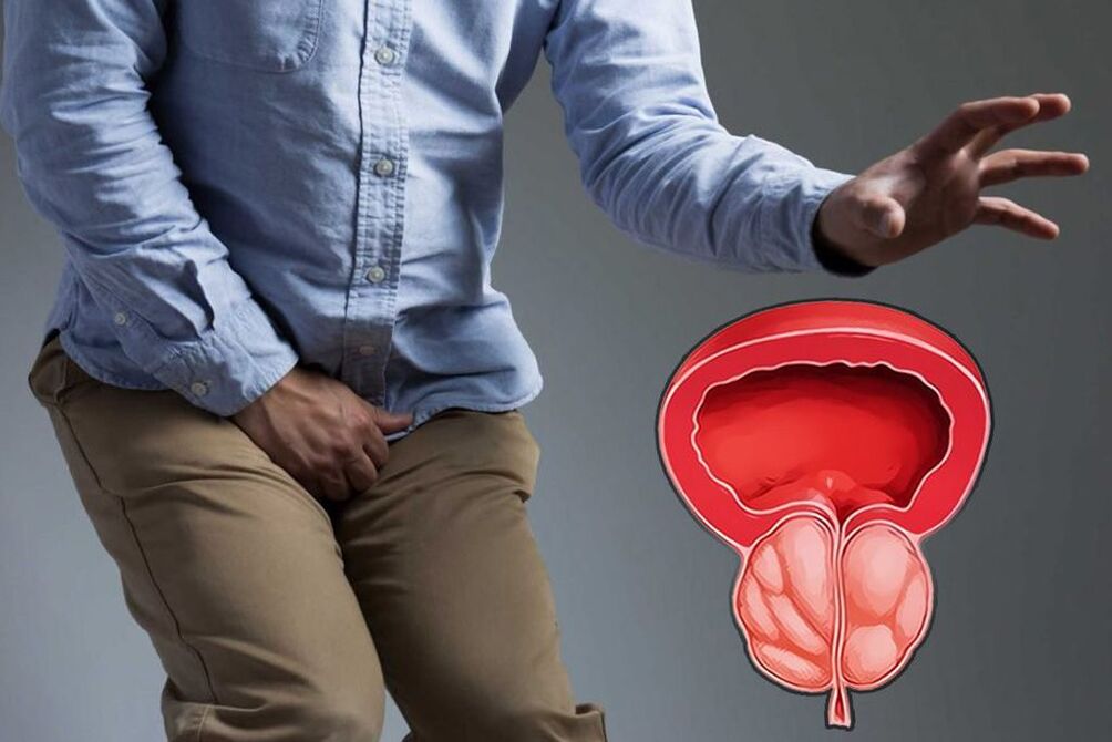 akutní prostata u mužů